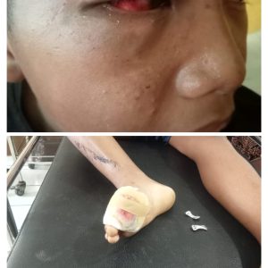 Bantu Korban Penganiayaan Anak Dibawah Umur. Hardizal: Korban Diharapkan Tetap Semangat
